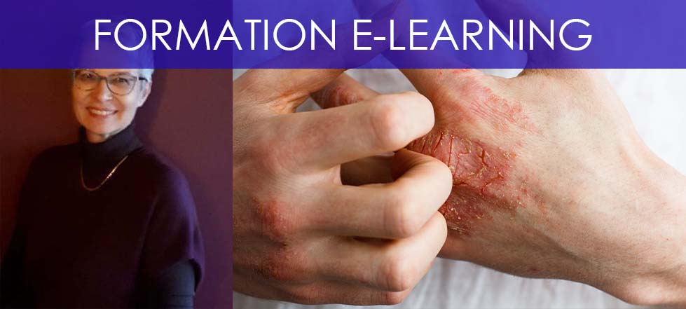 Formation e-learning dermatite atopique