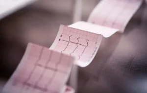 formation ecg medecin generaliste : interprétation d'un électrocardiogramme