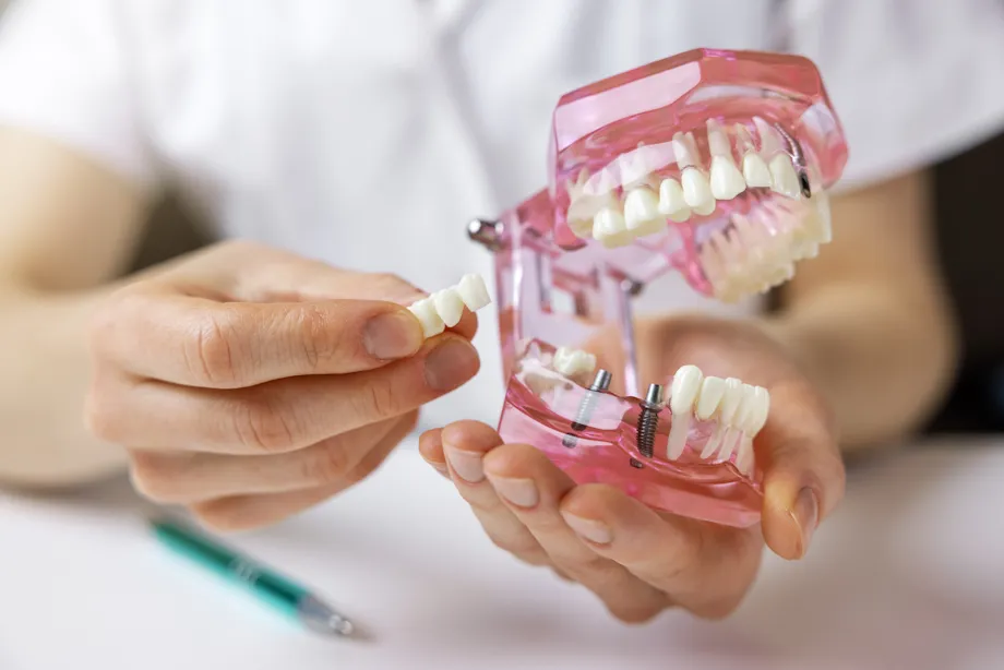 formation dpc comment bien demarrer en implantologie dentaire